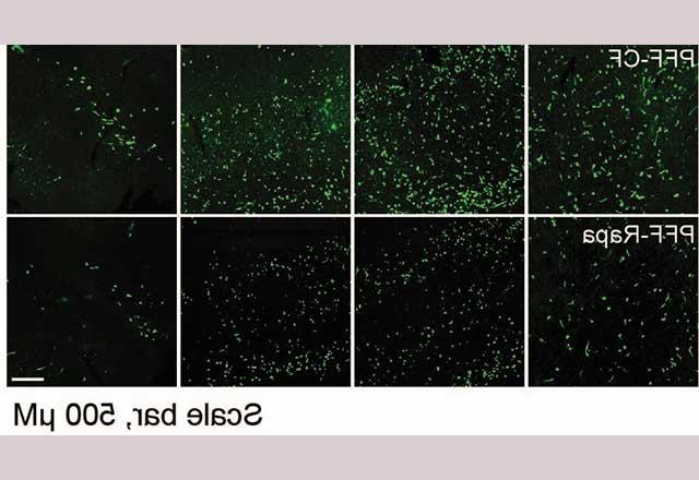  alpha-synuclein and its role in killing brain cells